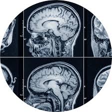 Neuroradiology Services